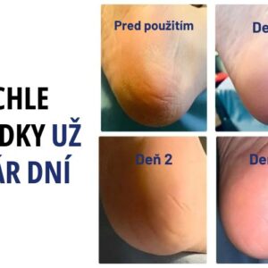 Hydratačné ponožky na popraskané päty - Heel - Image 4