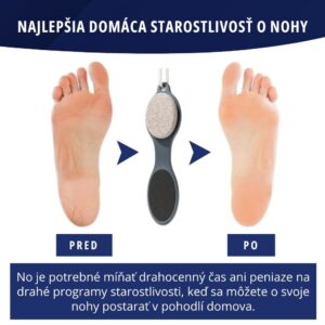 4-dielny pilník na starostlivosť o nohy - SoftFeet - Image 5