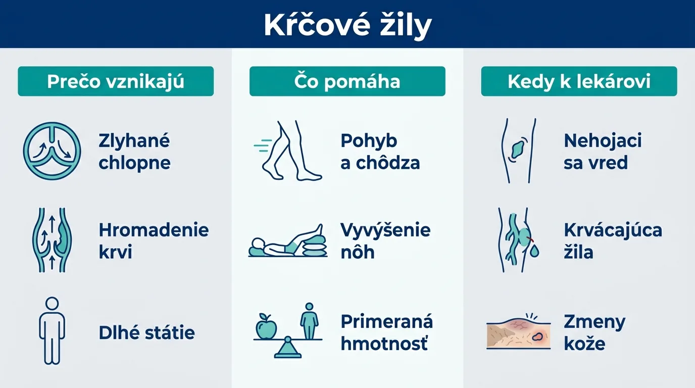 Infografika o kŕčových žilách zhŕňa príčiny, domácu úľavu a varovné príznaky.