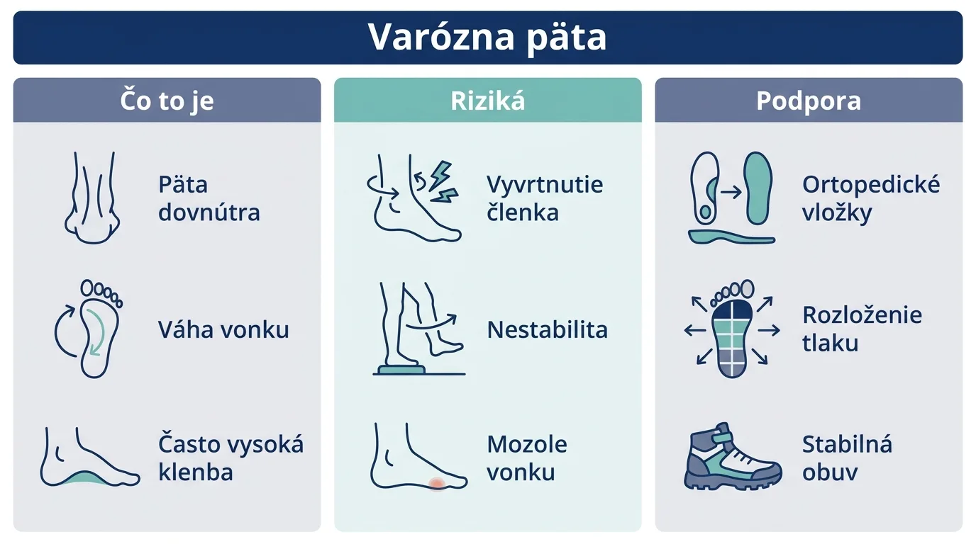 Infografika vysvetľujúca, čo je varózna päta, aké prináša riziká a ako ju podporiť vložkami.