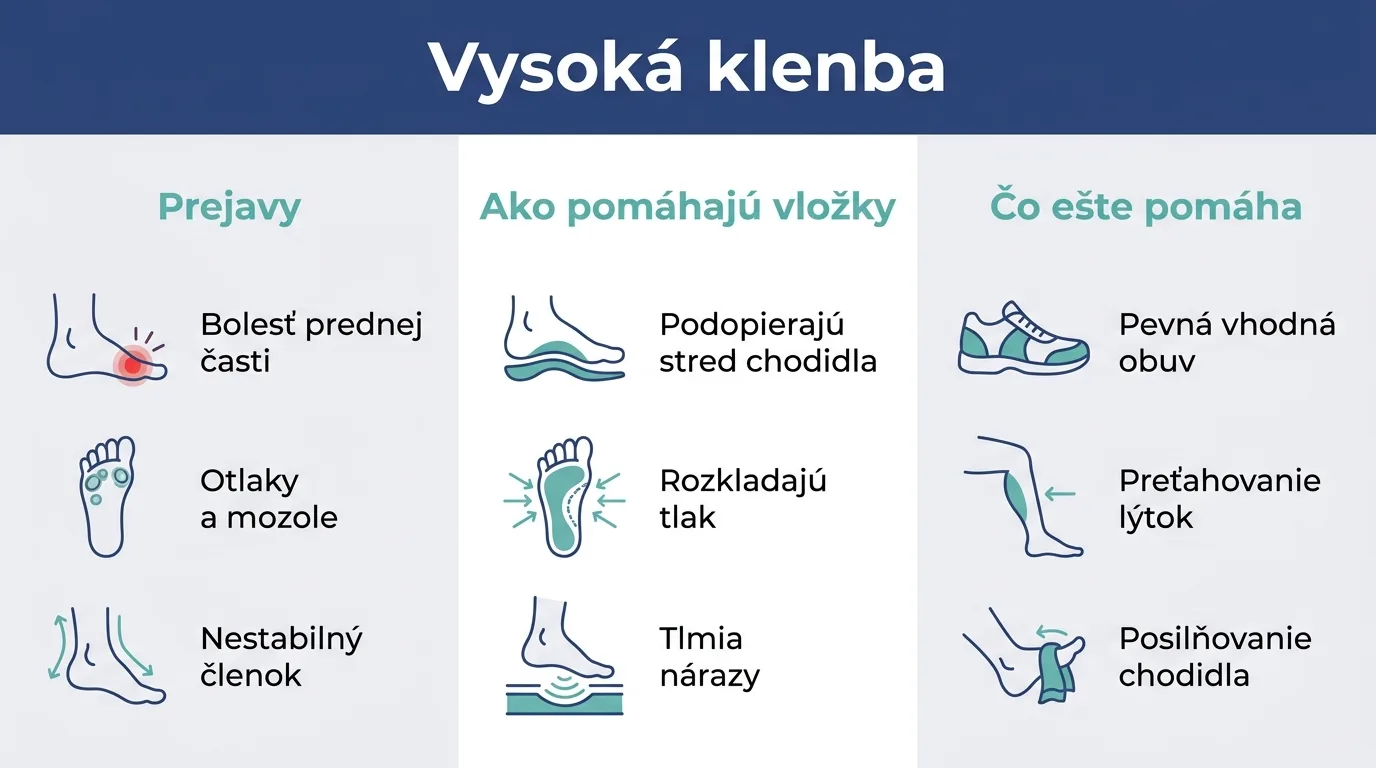 Infografika o vysokej klenbe nohy, jej prejavoch a podpore vložkami.